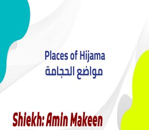 Places of Hijama مواضع الحجامة copy 300x263
